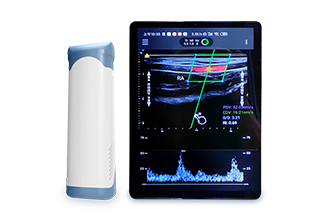掌上彩色多普勒超声诊断仪