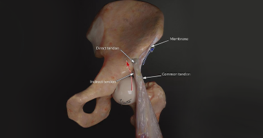 最新解剖结构发现—股直肌近端肌腱复合体膜